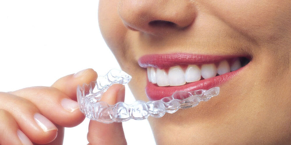 Invisalign